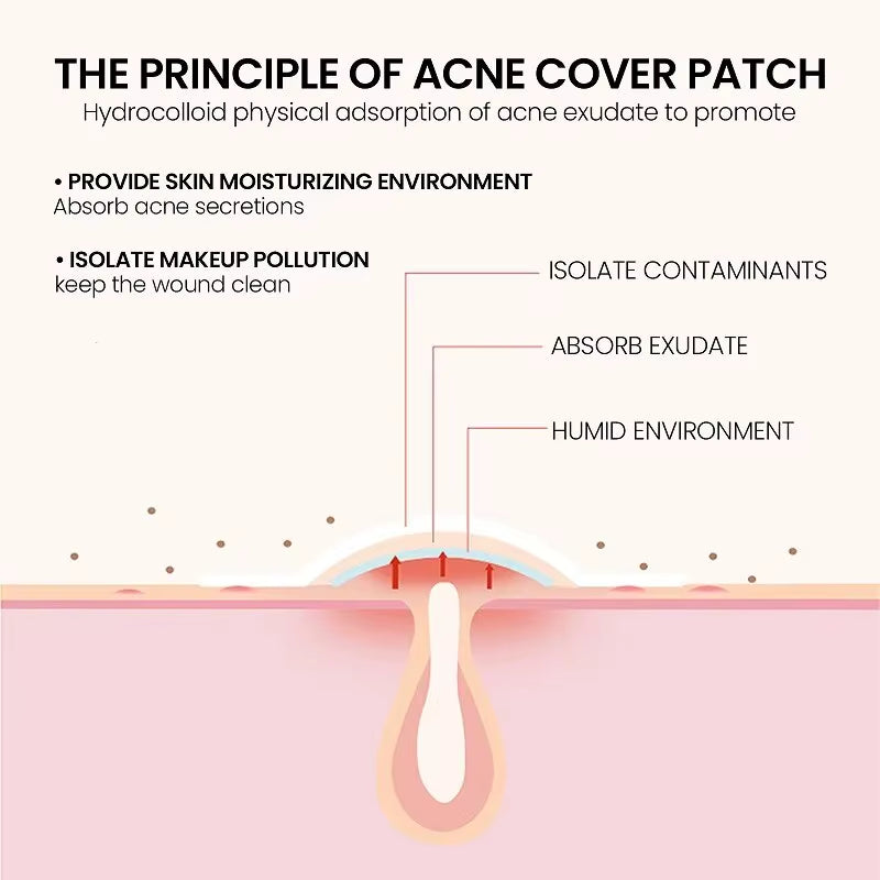 Repair Acne Patch Facial Skin Care Fade Blemishes Pimple Marks Closed Acne Blemishes Cover Acne Pimple Repair Patch